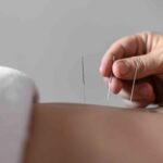 close-up-hand-holding-acupuncture-needle (1)
